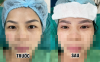 Thẩm mỹ mắt cùng chuyên gia tuyến Trung ương - Trả lại vẻ đẹp tự nhiên cho đôi mắt bạn