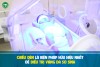 Cảnh giác với Vàng da ở trẻ sơ sinh
